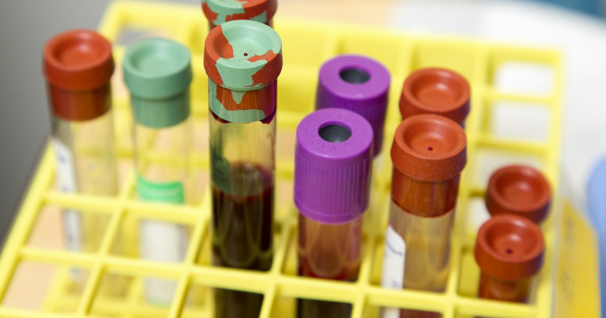 L-Tyrosine or N-Acetyl-L-Tyrosine: What's the Difference